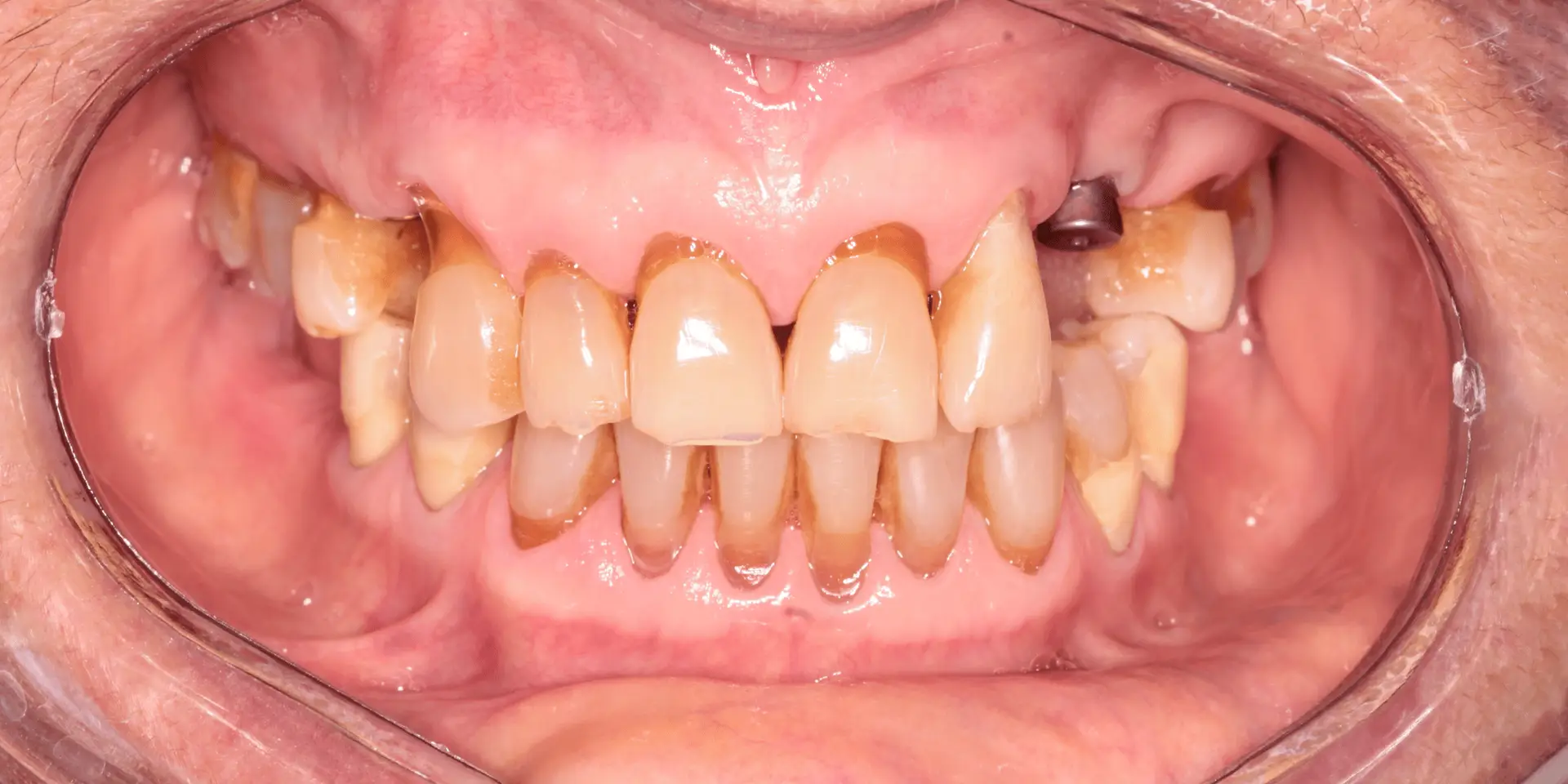 Controler02A Controler02A