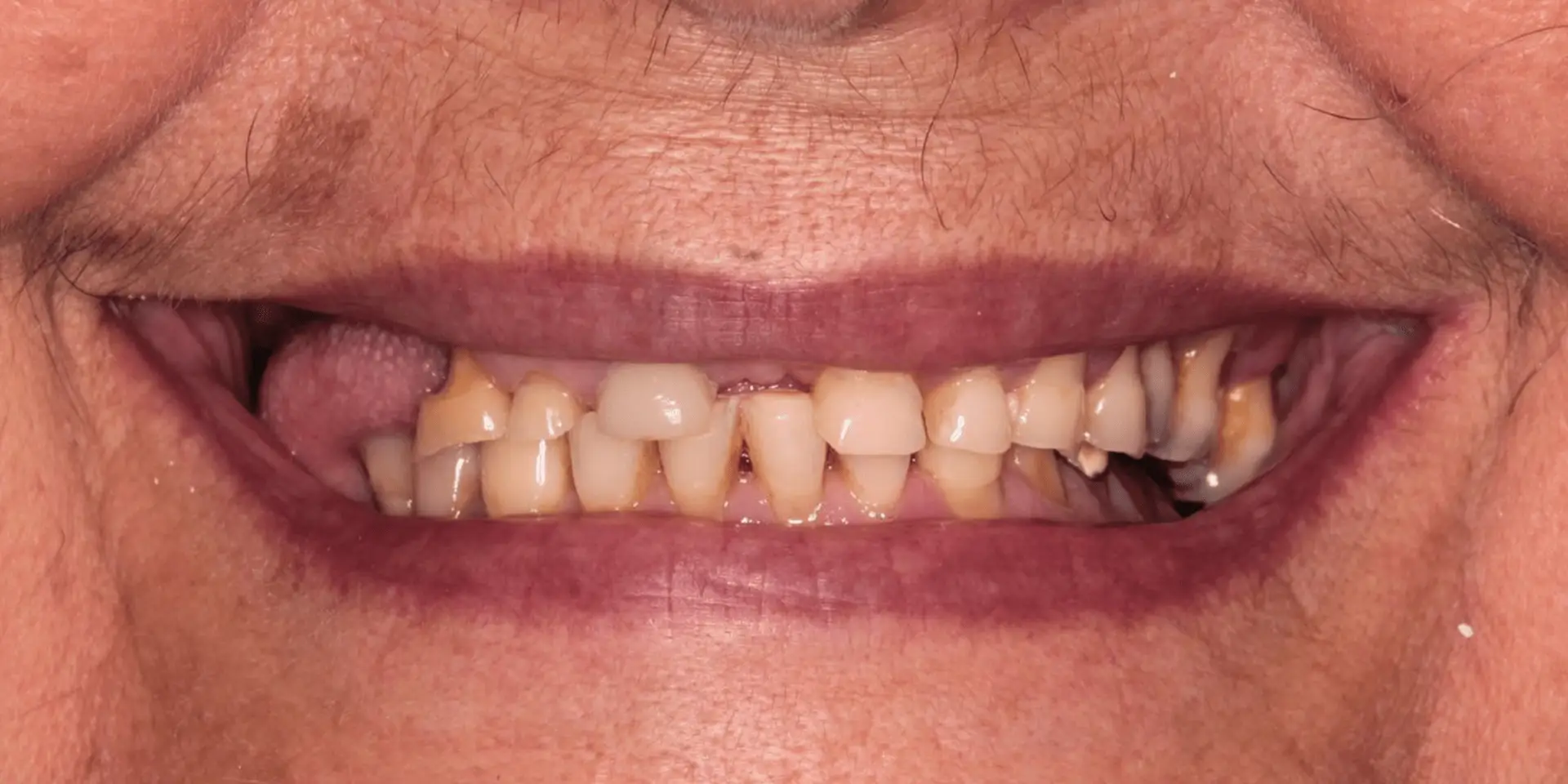 Controler03A2 Controler03A2