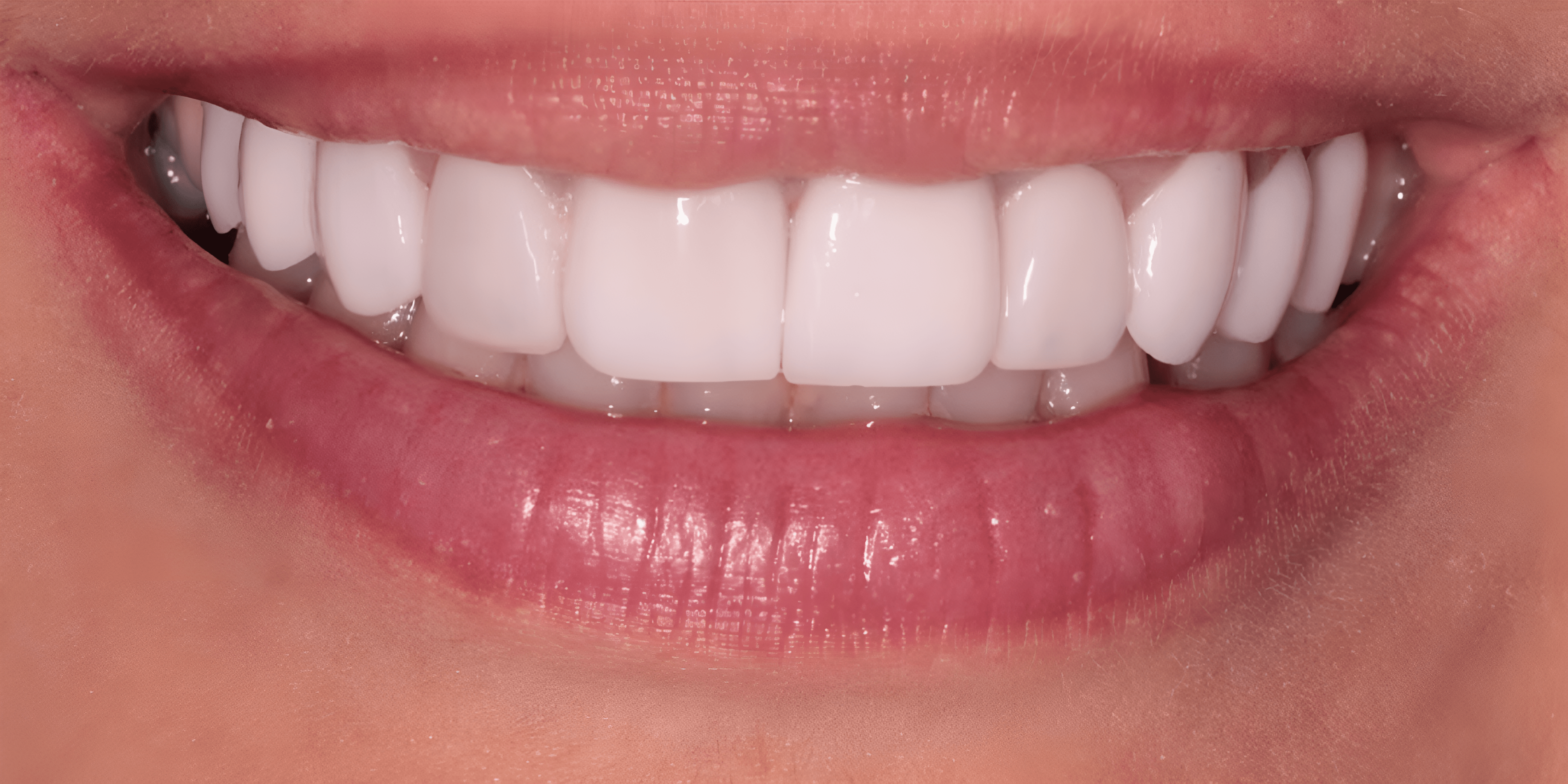 replicate-prediction-ahnjfbhk3rd53acvsic7wxkaqu