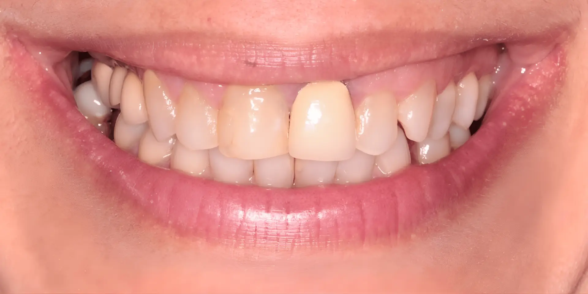 replicate-prediction-ebxaifpijrb4jheahr4jsllgna replicate-prediction-ebxaifpijrb4jheahr4jsllgna